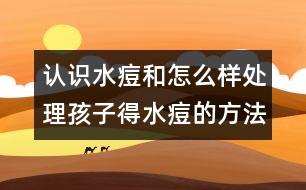 認(rèn)識水痘和怎么樣處理孩子得水痘的方法