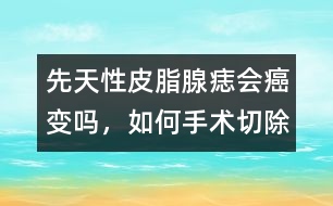 先天性皮脂腺痣會癌變嗎，如何手術切除