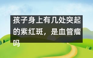 孩子身上有幾處突起的紫紅斑，是血管瘤嗎