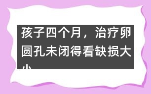 孩子四個月，治療卵圓孔未閉得看缺損大小