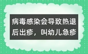 病毒感染會(huì)導(dǎo)致熱退后出疹，叫幼兒急疹